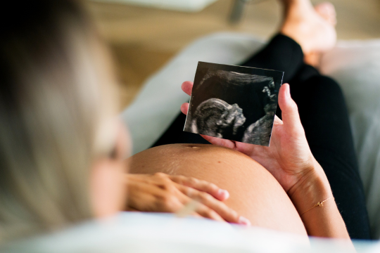 A pregnant woman lying on a bed with one hand on her belly, holding a printed ultrasound image of her baby, symbolizing connection and anticipation during pregnancy.