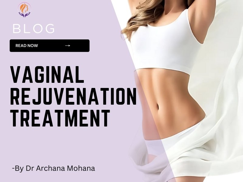 A fit woman in a white sports bra and skirt, with a toned midsection, against a soft lavender background with text promoting vaginal rejuvenation treatment by Dr. Archana Mohana.