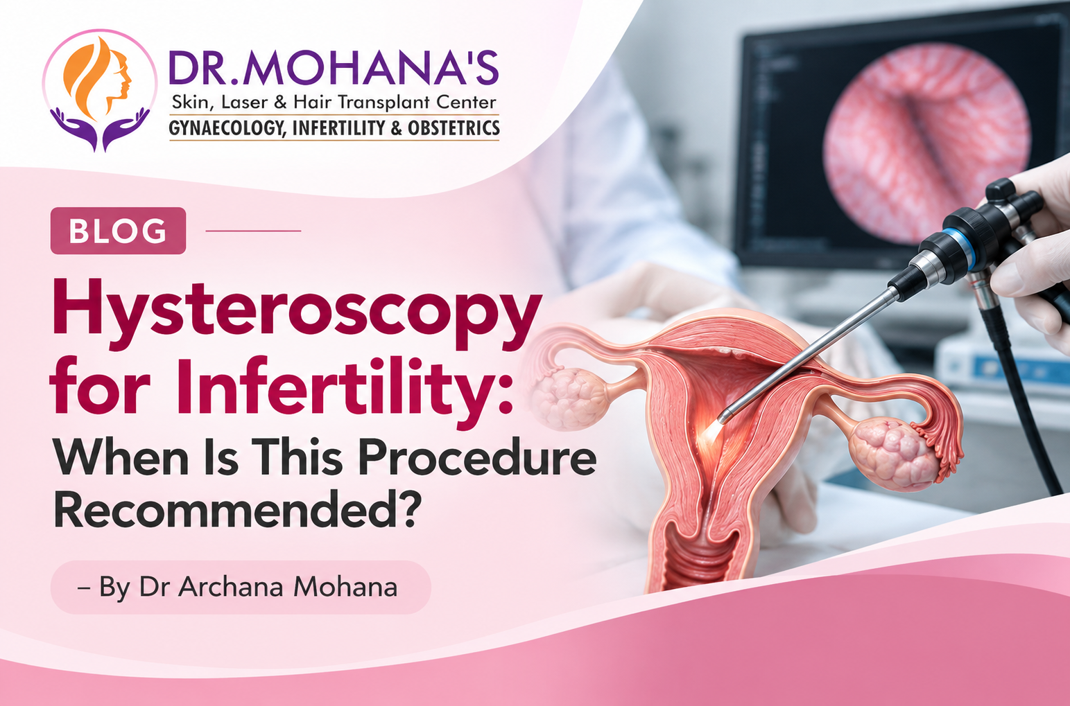 Hysteroscopy for infertility showing uterine evaluation and fertility assessment