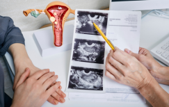 A healthcare professional reviews ultrasound images with a patient during a consultation. A reproductive organ model is displayed on the desk, and the doctor is pointing to a scan while the patient listens attentively.